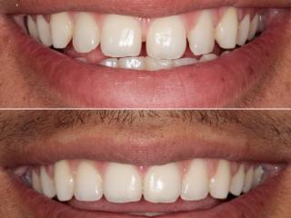 Orthodontics