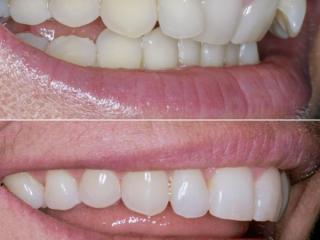 Orthodontics