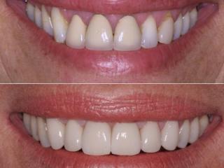 Orthodontics