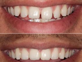 Orthodontics
