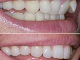 Orthodontics