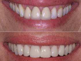 Orthodontics